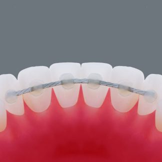 Fir contentie torsadat plat