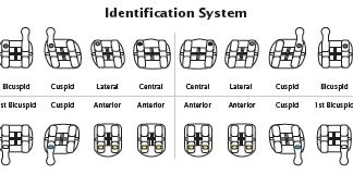 Sistem de brackeți metalici PINNACLE Ortho Technology